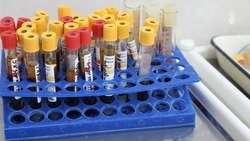 На Ставрополье показатель заболеваемости ВИЧ-инфекцией за год снизился на 4,6%