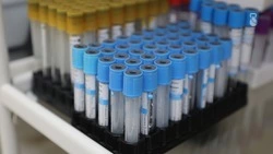 Проверяться на гепатит C нужно ежегодно — минздрав Ставрополья 