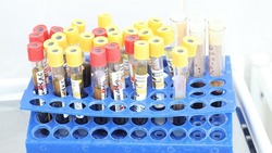 Жителей Железноводска приглашают сдать кровь 31 июля